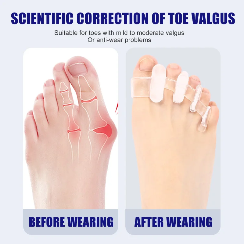 1 paio di separatori per dita  - Toe Separator Silicon recensione e prezzo