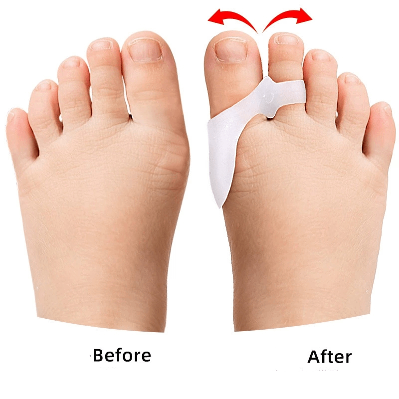 1/2/3 paia Per Bambini Gel Toe - Toe Separator Silicon recensione e prezzo