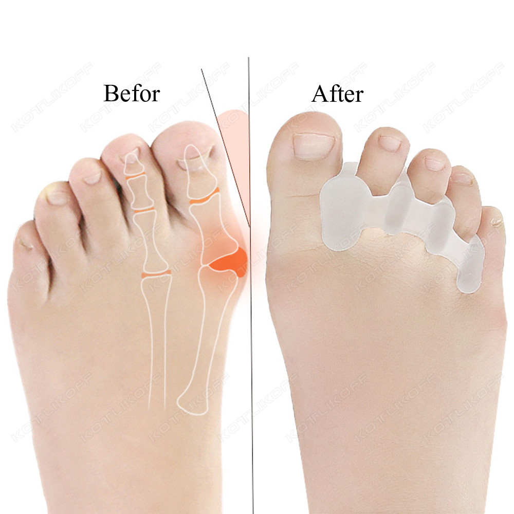 Punta protettiva Dita dei pied - Toe Separator Silicon recensione e prezzo