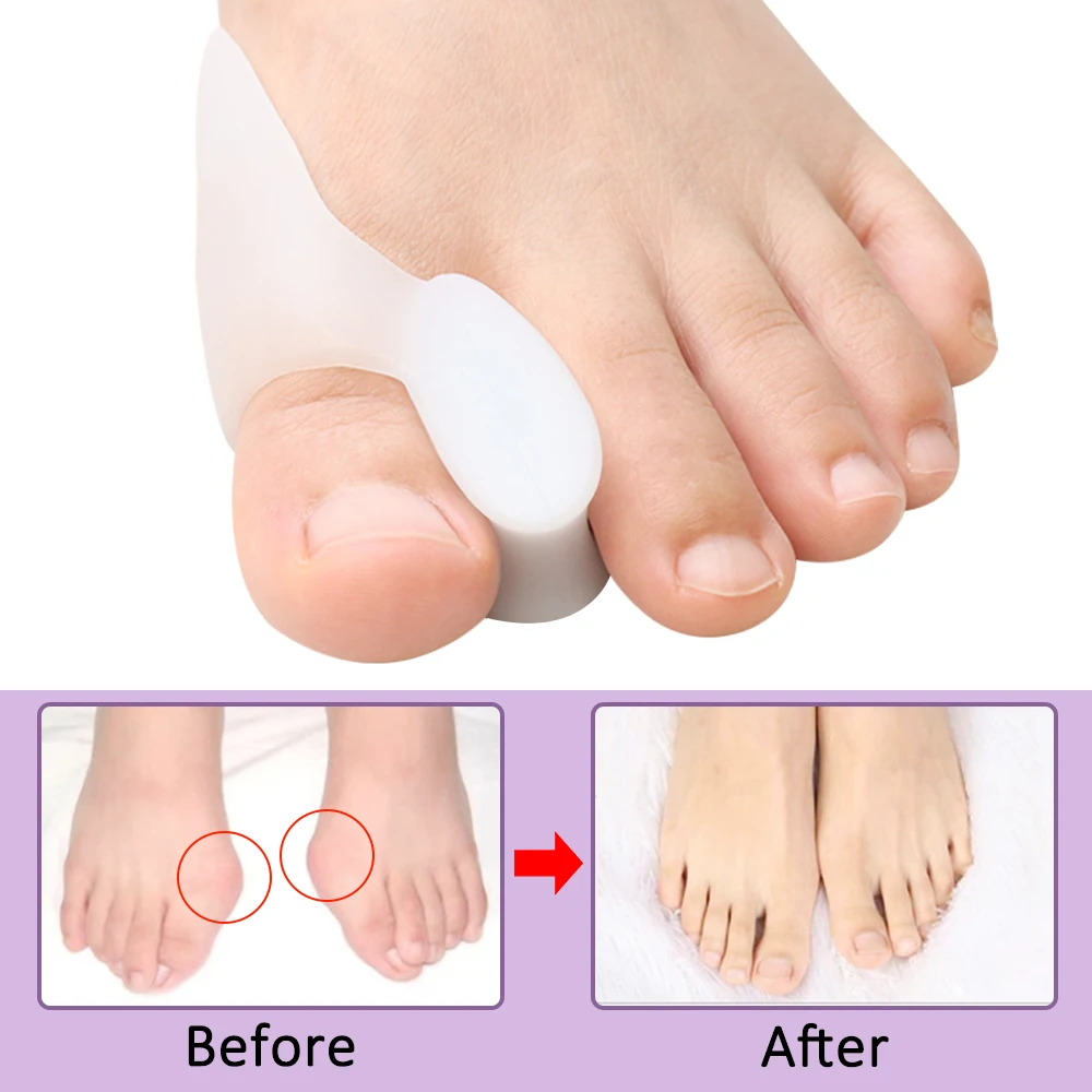 2/4/8 Pezzi Distanziatore in G - Toe Separator Silicon recensione e prezzo