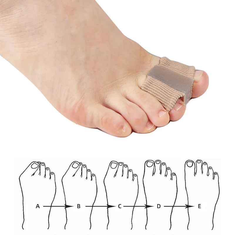 Separatori per dita dei piedi  - Toe Separator Silicon recensione e prezzo
